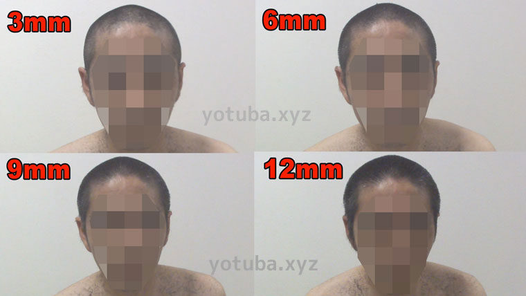坊主刈り12mm～3mm顔側