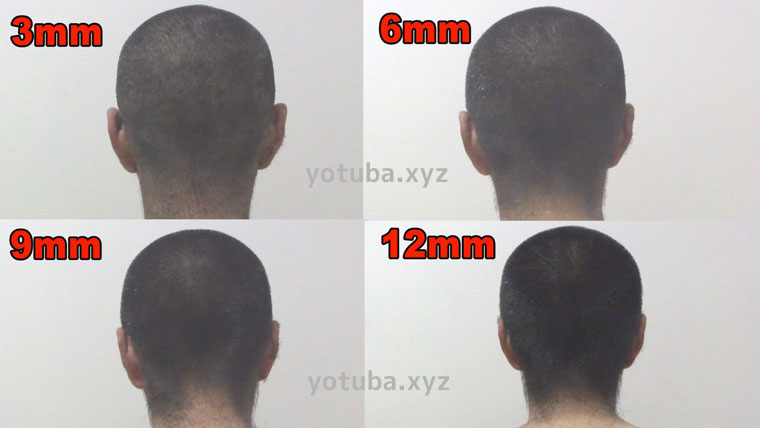 坊主頭12mm-3mm後頭部側