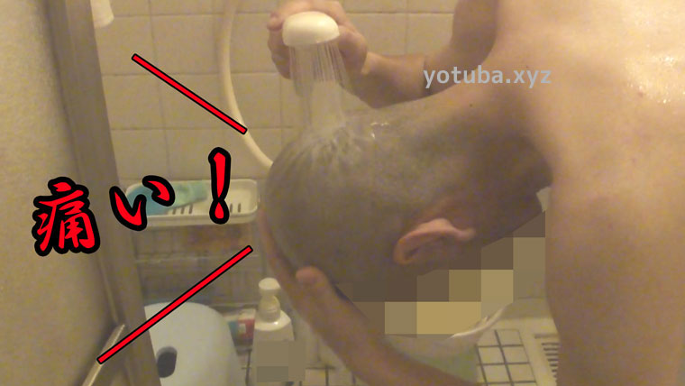 坊主刈りにシャンプーはしみる