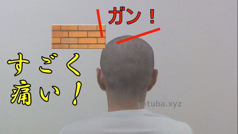 坊主頭に物が当たると痛い