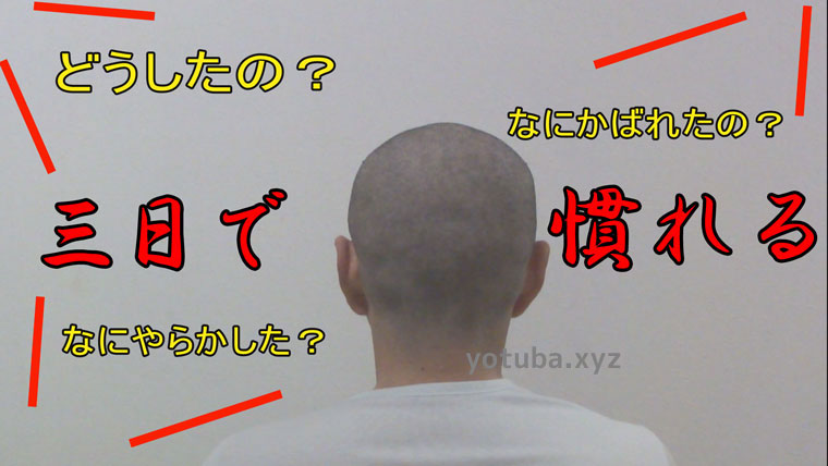 周囲が坊主刈りに驚く