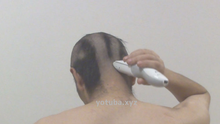 後頭部バリカン散髪